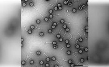 pneumonia