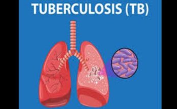 tb